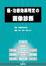 癌・治療効果判定の画像診断