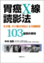 胃癌X線読影法