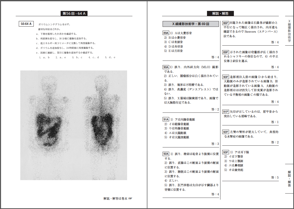 診療放射線技師国家試験 撮影・読影問題 総ざらい 第1版